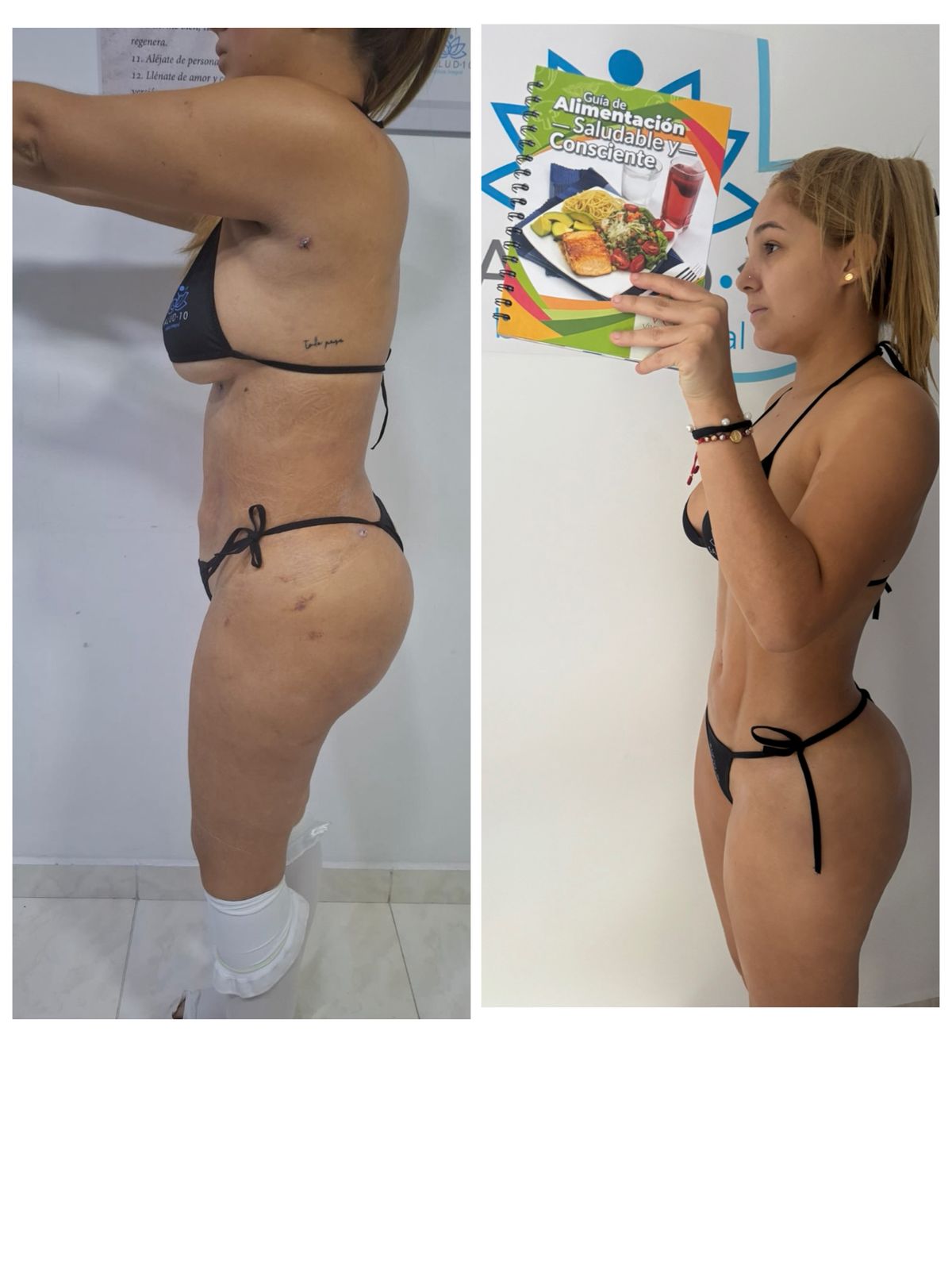 Resultado Salud 10 Medellín