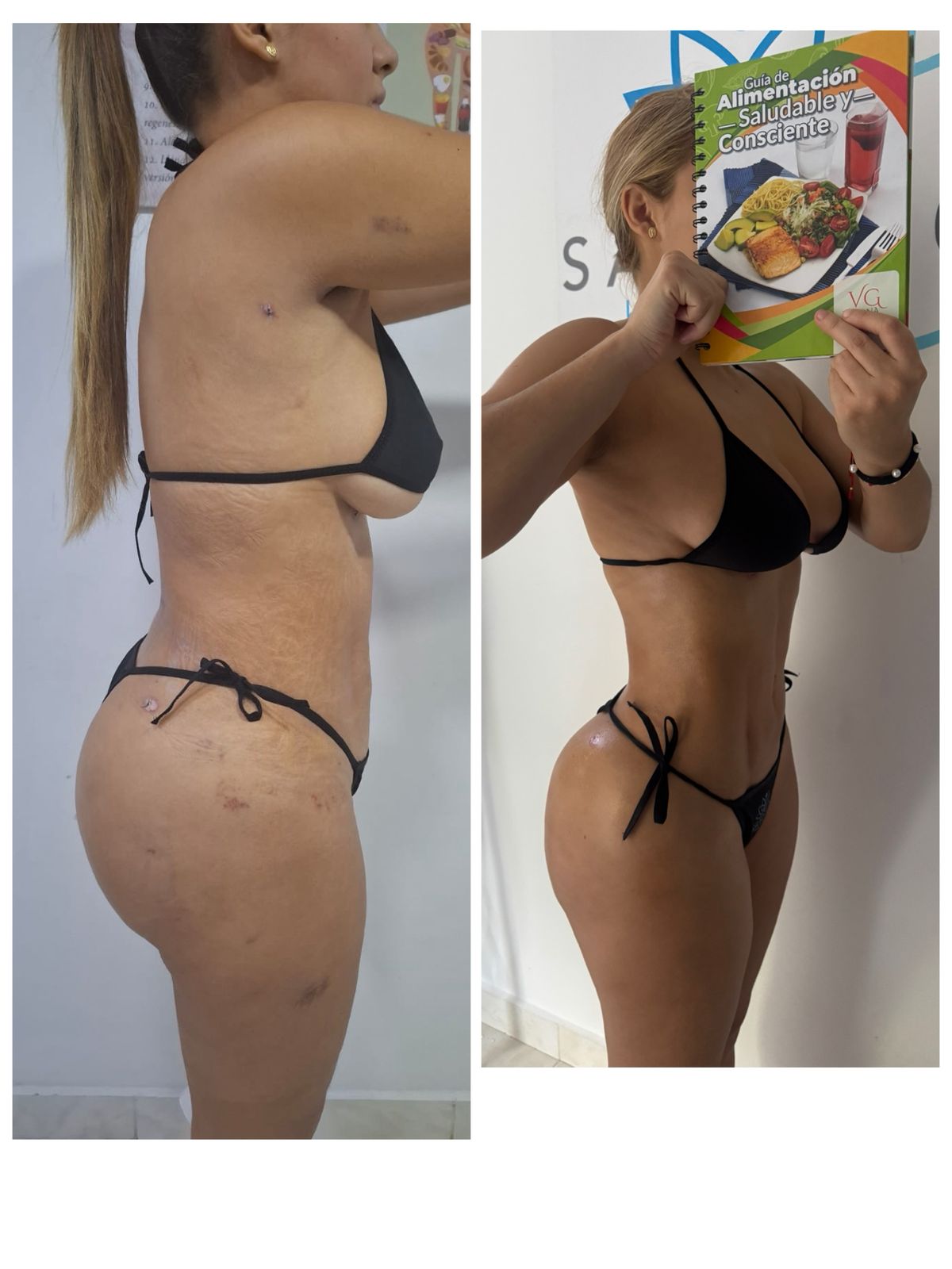 Resultado Salud 10 Medellín