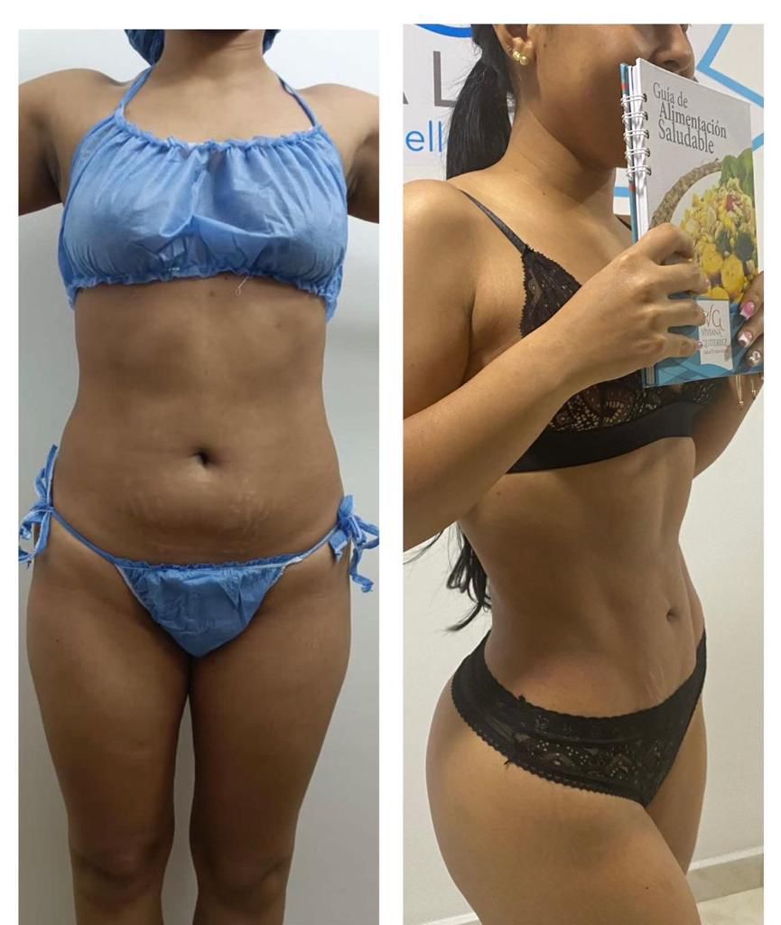 Resultado Salud 10 Medellín