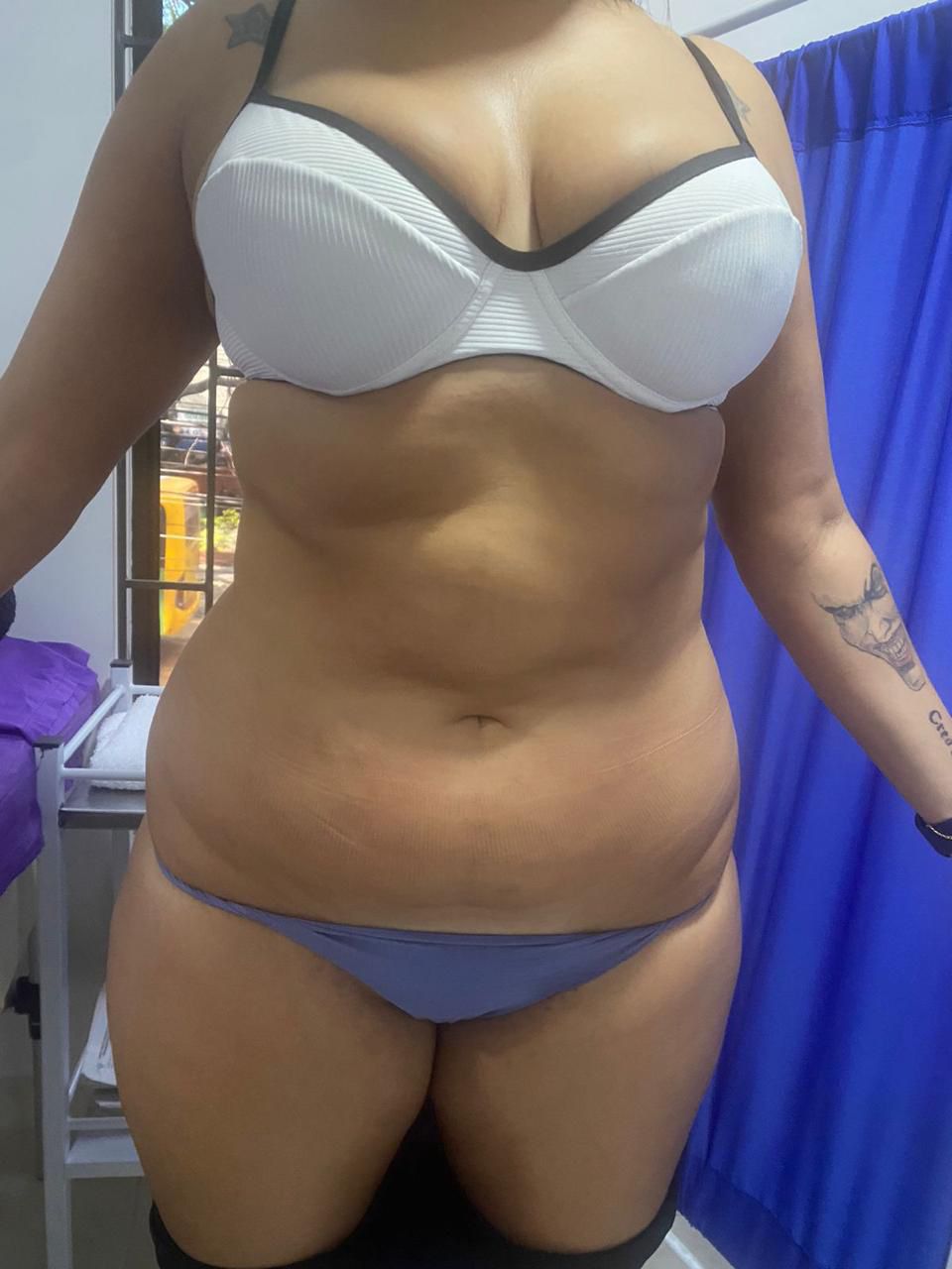 Resultado Salud 10 Medellín